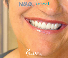 Slider image (2) Nava Dental Care